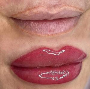 micropigmentacion labios antes y despues